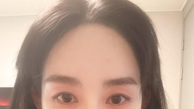 [왓IS] 권민아, 피부과 측과 갈등 녹취록 풀고... AOA 괴롭힘 사건 재소환