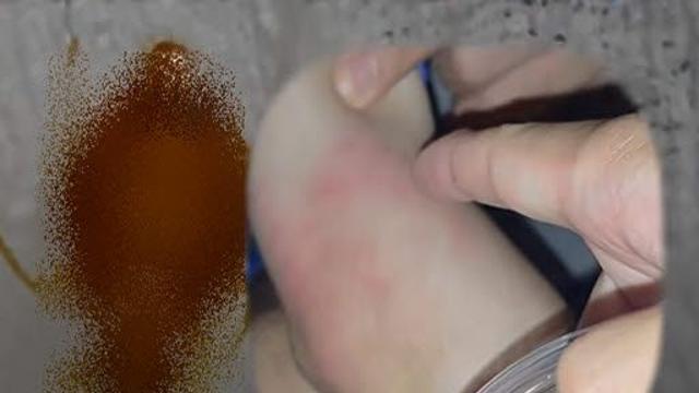 부산 찜질방 '역대급' 빈대 서식지 발견 ...