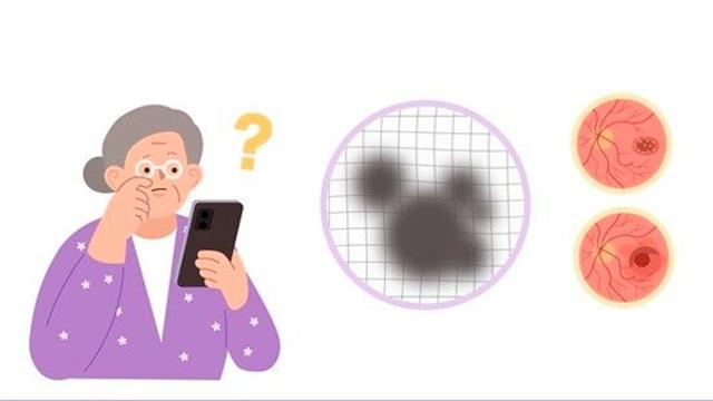 직선이 구불구불 휘어 보인다면…황반변성? 황반원공?