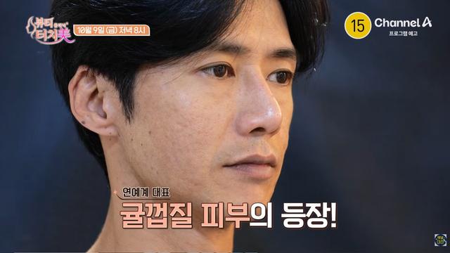 오종혁, ‘귤껍질 피부’ 감추려 두꺼운 화장…오히려 악순환