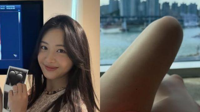 ‘배성재♥’김다영, 12월 출산 앞두고 D라인 공개… “물풍선 같기도”