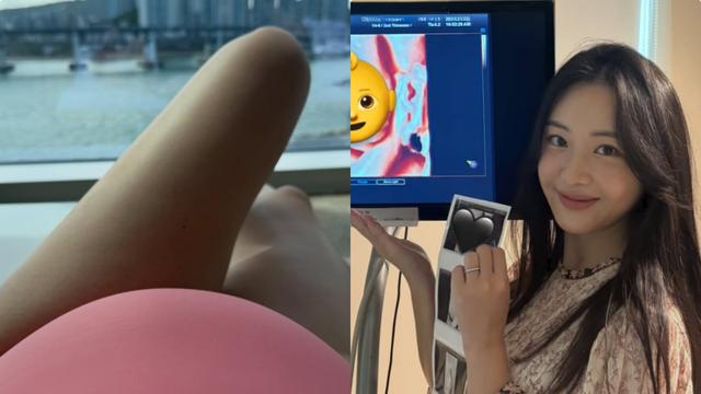 김다영, ♥배성재와 12월 출산 앞두고 D라인 공개…“물풍선 같기도”