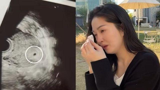 ‘전진♥’ 류이서, 시험관 임신 7주 차에 유산…”남편도 마음 고생해” 눈물 [RE:뷰]