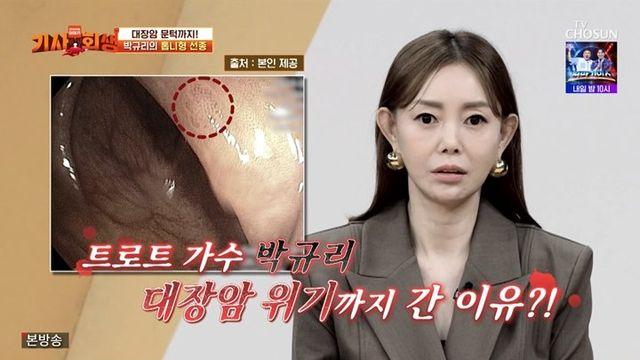 트로트 가수 박규리, 대장암 직전까지 갔다 “매년 용종 3~4개 제거”