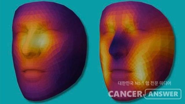 “얼굴에 건강이 보인다”… 암 환자 치료 돕는 AI 등장