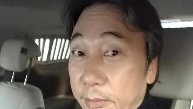 이문세, 갑상선암 투병 이어 백내장 수술…”노안 수술도 함께” [IS하이컷]