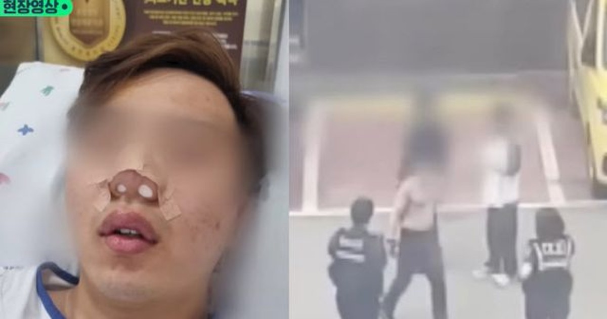 "아내 폭행하다".…