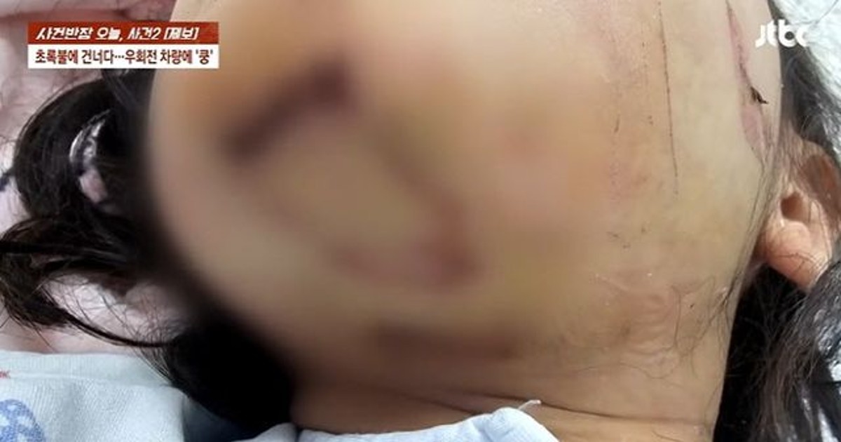 “어, 밟혔네?” 초등생 들이받은 8