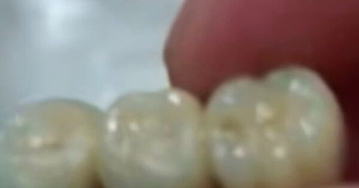 딤섬·소시지서 인공…