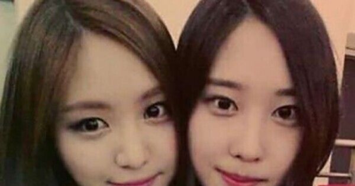 손나은 비보, 도대체 무슨 일이...